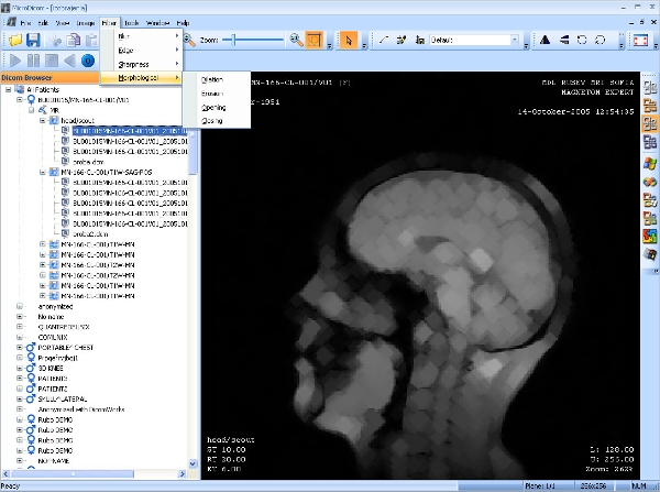 x ray viewer for mac free